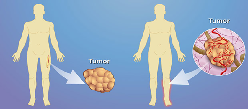 Dr Dipanjan Biswas Best Surgical Oncologist In Raipur Chhattisgarh