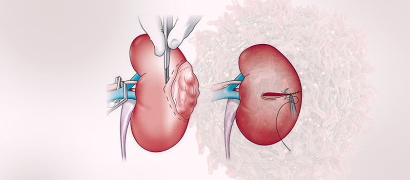 Best Surgical Oncologist in  Raipur,Chhattisgarh